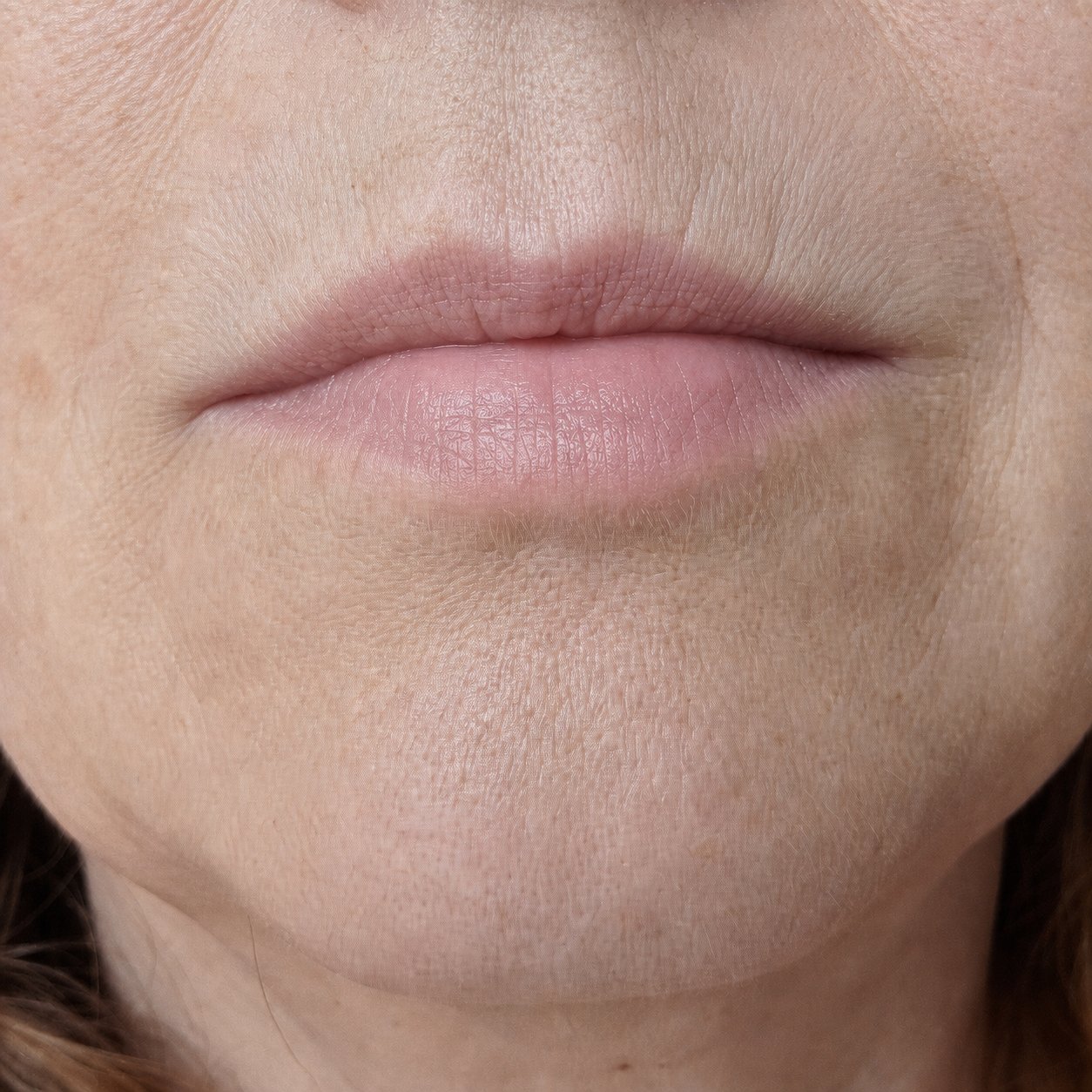 Same mature woman's lower lip 48 hours later with prodrome resolving and no outbreak having developed after early intervention with Labisan Protective Lip Balm