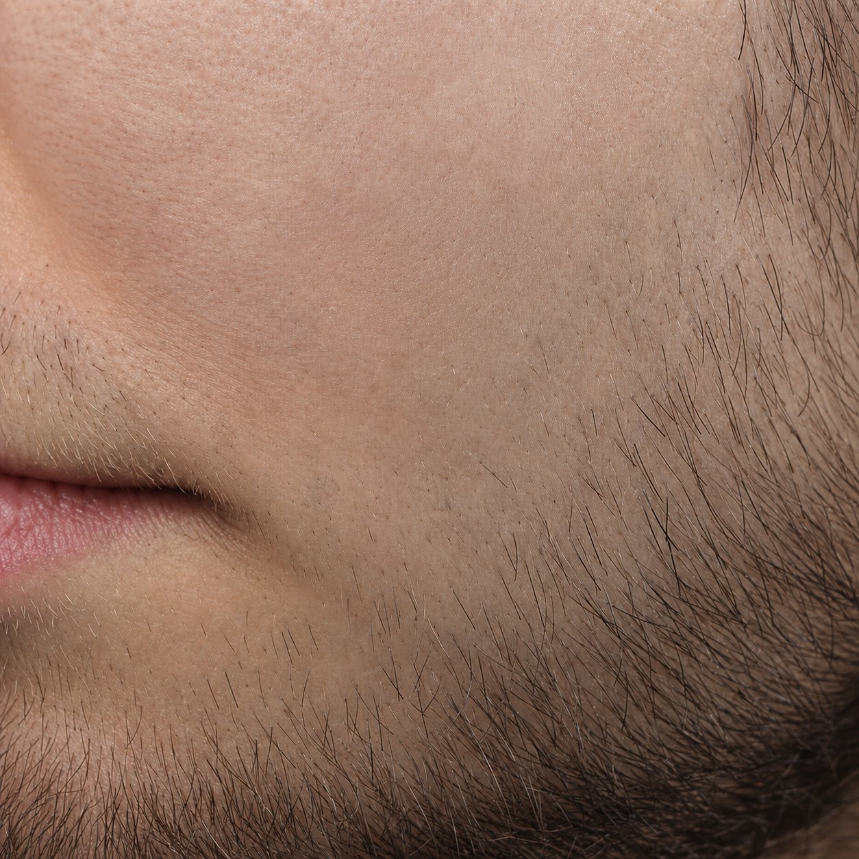 Same cheek 48 hours later, peri-oral lesion actively healing on the Labisan Protective topical protocol